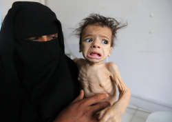 UN: Millions In Yemen Face Severe Famine