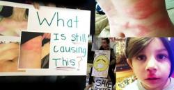 Media Silent As Mystery Illness Plagues Residents One Year After Historic US Gas Leak Media Silent As Mystery Illness Plagues Residents One Year After Historic US Gas Leak