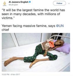 Millions Face Starvation In Yemen Due To US-Ally Saudi Arabia's Blockade