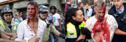 Caracas Or Catalan - Nightstick Democracy At Its Finest... Caracas Or Catalan - Nightstick Democracy At Its Finest...