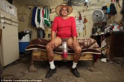 Mexican Man Officially Granted Disabled Status For Having Giant Penis